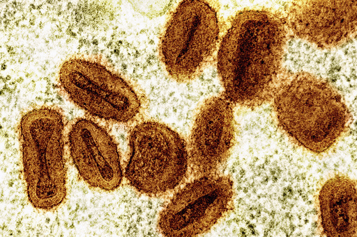 US health authorities confirm initial case of new mpox variant in a traveler