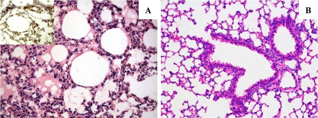 Newly Emergent Highly Pathogenic H5N9 Subtype Avian Influenza A Virus (Photo: Journal of Virology)