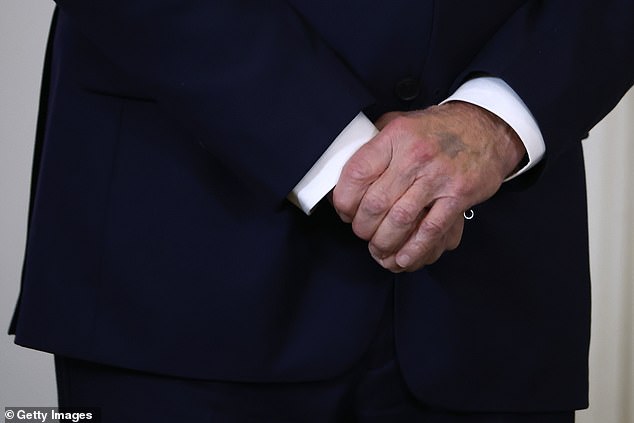 Mysterious Mark on Biden's Hand (Photo: Daily Mail UK)