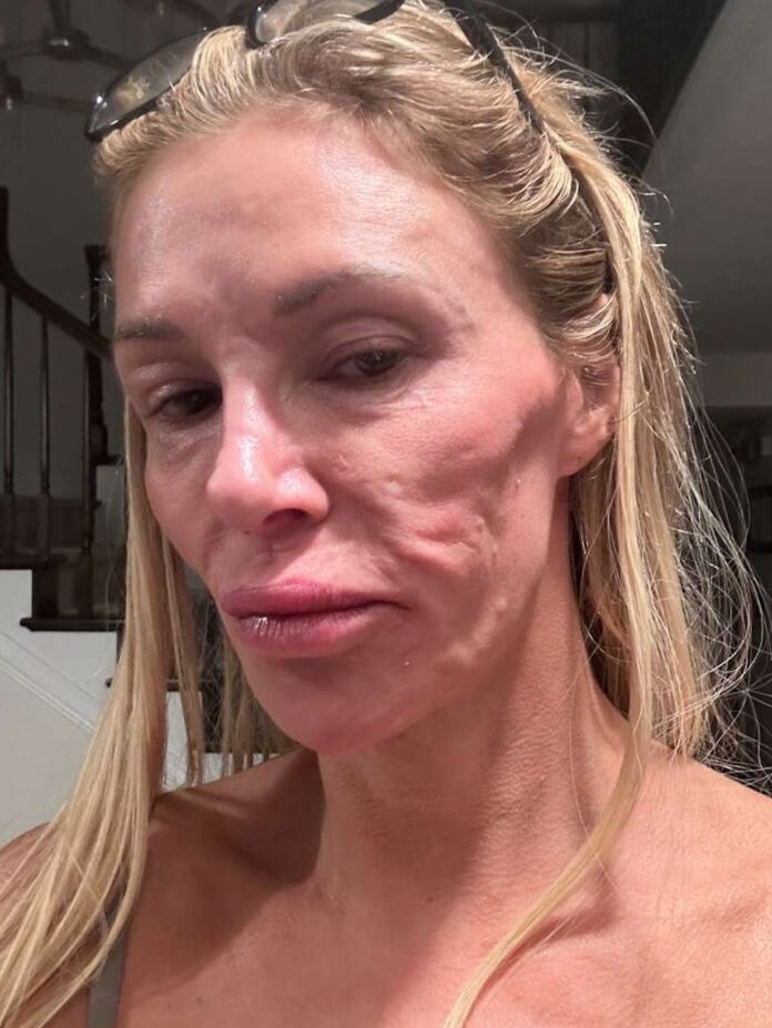 Brandi Glanville Struggles